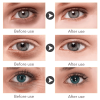 Anti Dark Circle Eye Serum Oil Retinol Anti Wrinkle Firming Skin Remove Eye Bag Fade Fine Line Whitening Brighten Eye Care Korea