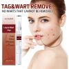 Jaysuing Skin Wart Care Pen for Smoothing Body Skin, Mildly Cleansing Skin Tags, and Care Solution Pen