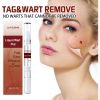 Jaysuing Skin Wart Care Pen for Smoothing Body Skin, Mildly Cleansing Skin Tags, and Care Solution Pen