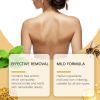 Wiyun Bee Venom Skin Care Cream Natural and Gentle Skin Mole Removal Skin Care Cream for Cleansing